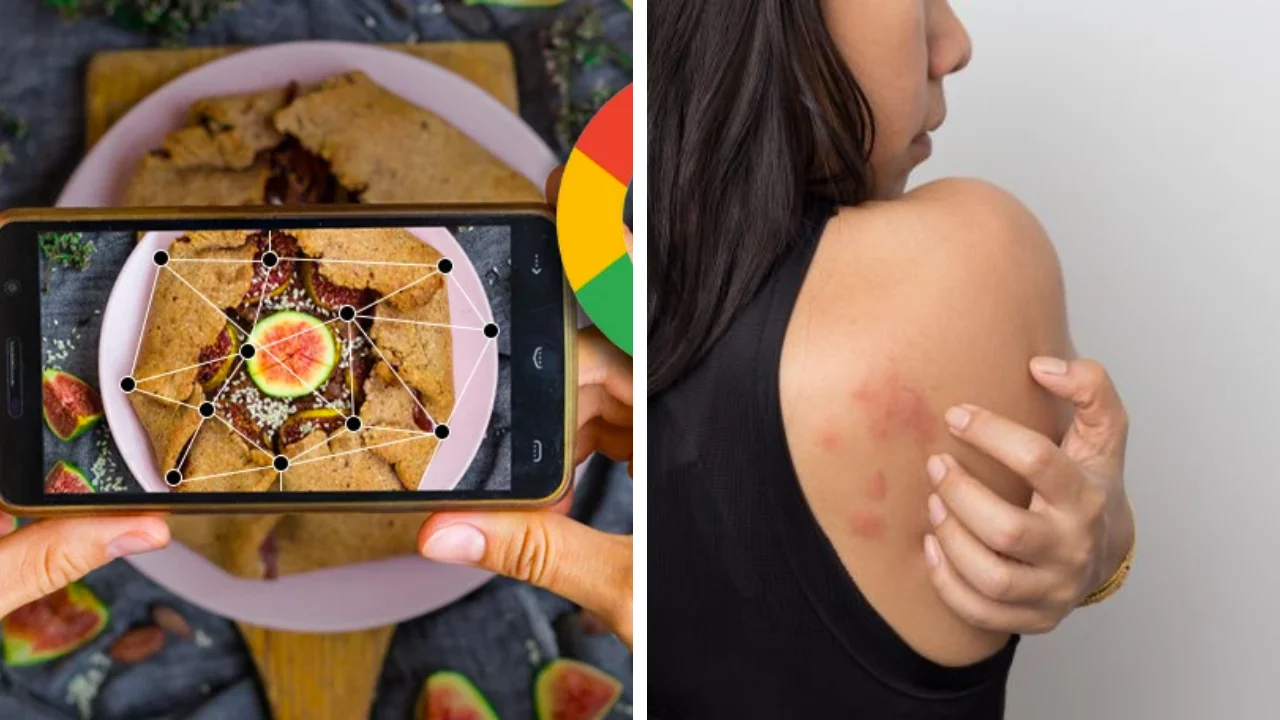 goole lens will now detect your skin rashes