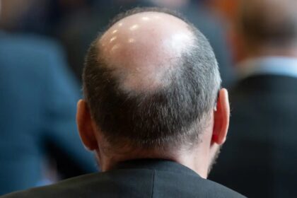 sugar gel cure baldness