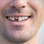 Japanese scientists regrow teeth