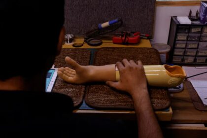 Bioniks 3D-printed bionic limbs.