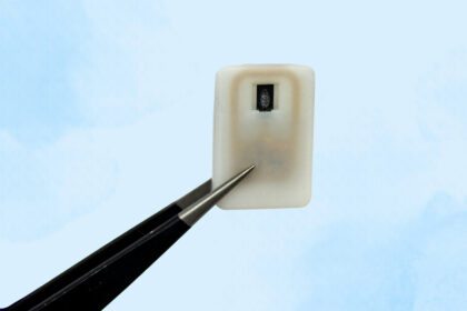 MIT diabetes implant