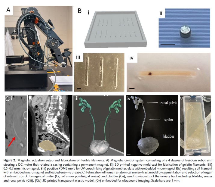 tiny magnetic robot dissolve kidney stones