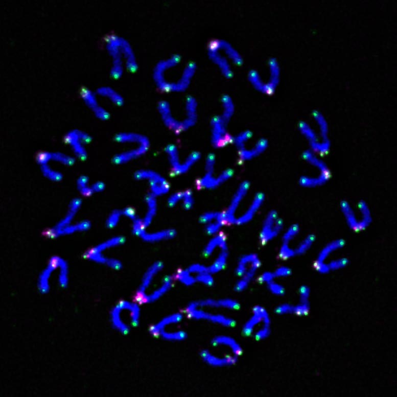 Cancer-fighting T cells
