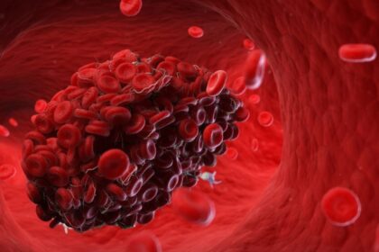intermittent fasting heart blood clots