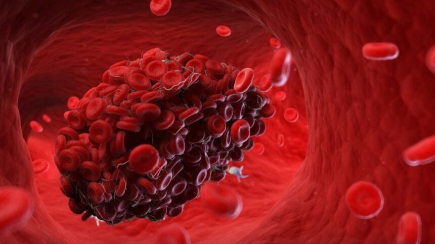 intermittent fasting heart blood clots