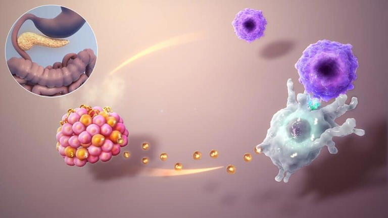 CRISPR Pancreatic Transplant Helps Diabetes Patient