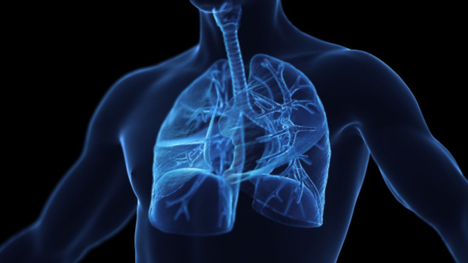 3D-printed windpipe