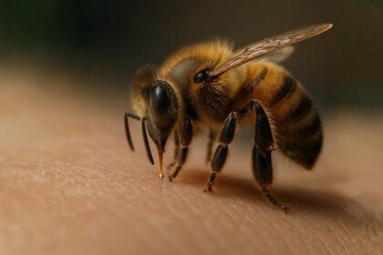 honeybee venom Breast Cancer