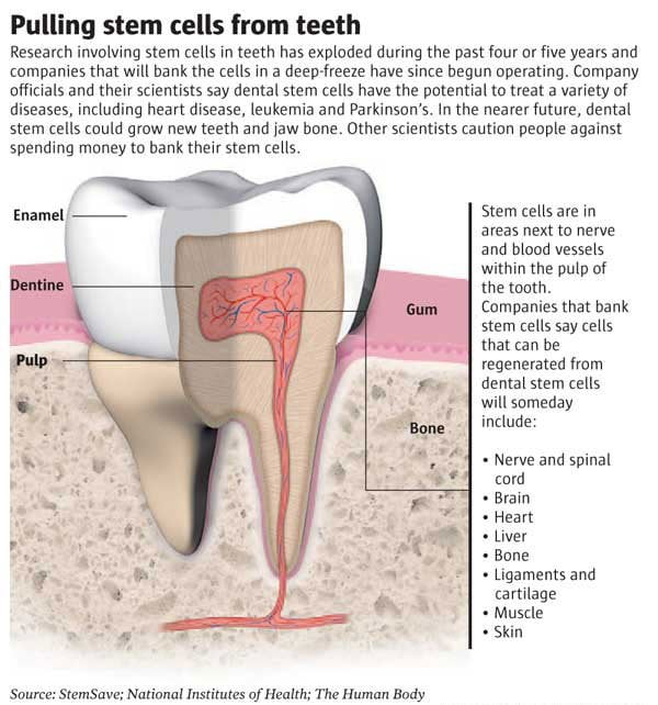 Stem Cells Wisdom Teeth