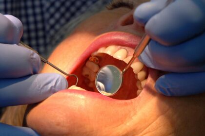 protein gel regrow tooth enamel