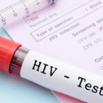 HIV treatment antiretroviral therapy