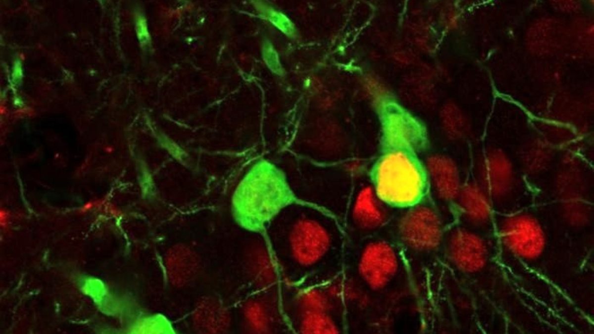 Fluorescence microscope image of brain neurons with green and red stained cells showing cocaine hijacks brain circuit activity