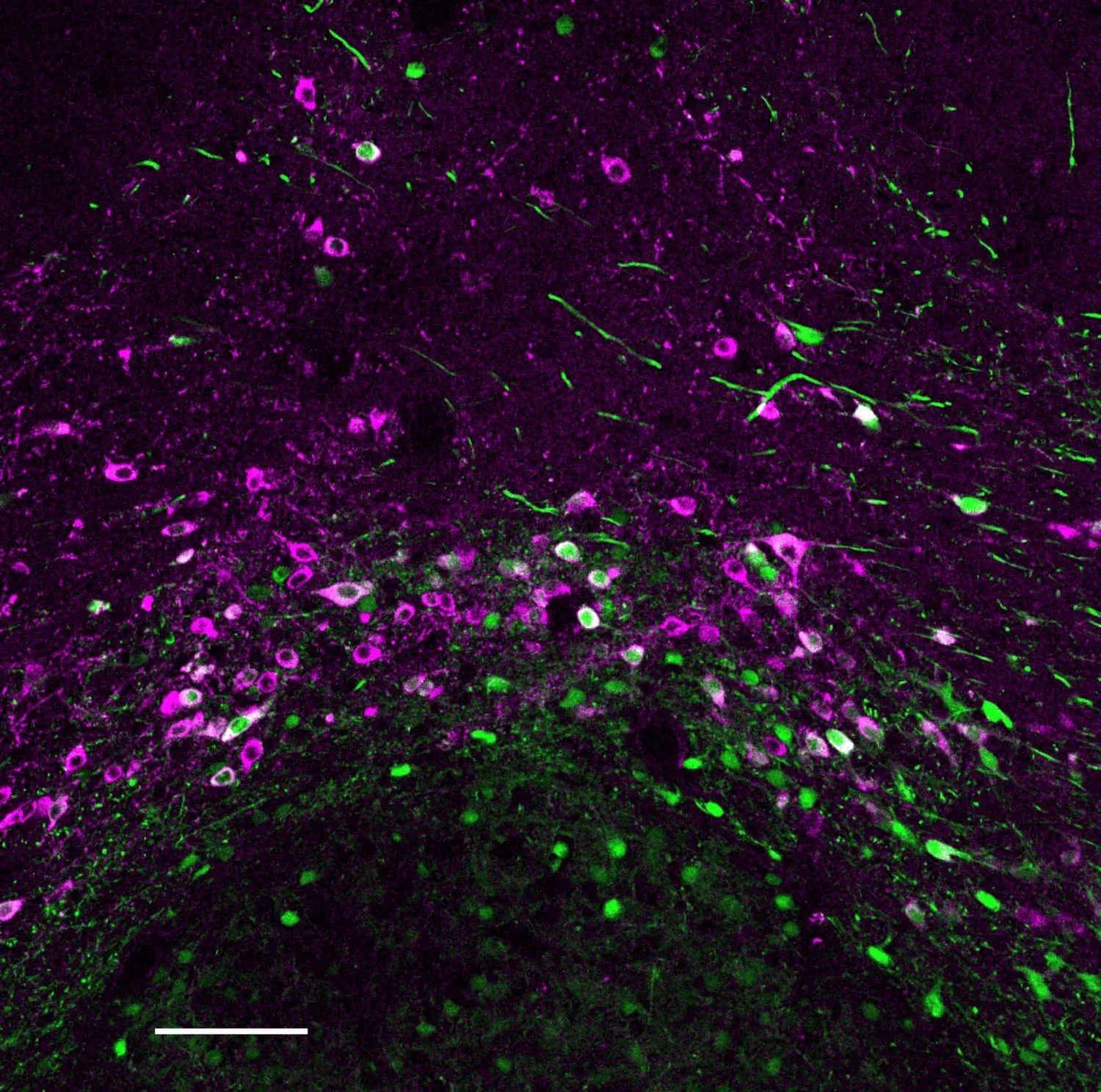 Microscope view of brain tissue showing neural circuits that cocaine hijacks to drive compulsive behavior